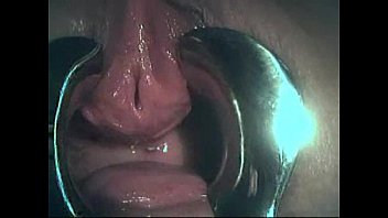 Naughty Tinkerbell Urethra