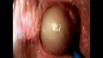 Head Shoved In Vagina