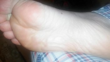 Bunion Feet Porn Pics