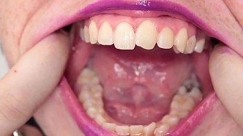 Teeth Fetish