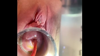 Cervix Insertions Porn Video