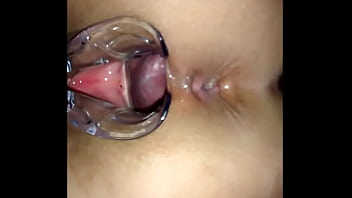 Speculum porn