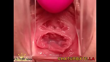 Cervix cumming