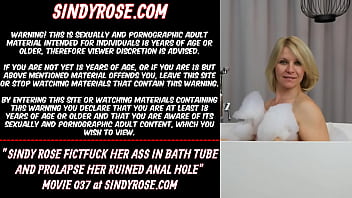 Anal fisting tube