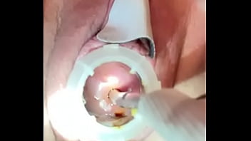 Orgasmo cervical