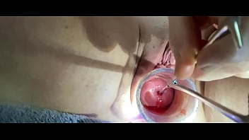 Cervical penetration porn