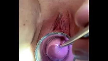 Penetration cervix