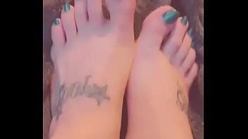 Conjoined toes