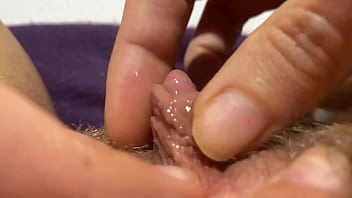 Extremely large clitoris