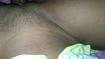 Nuno vale propofol