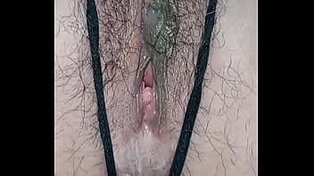 Hairy anal